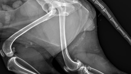 Hip dislocated
